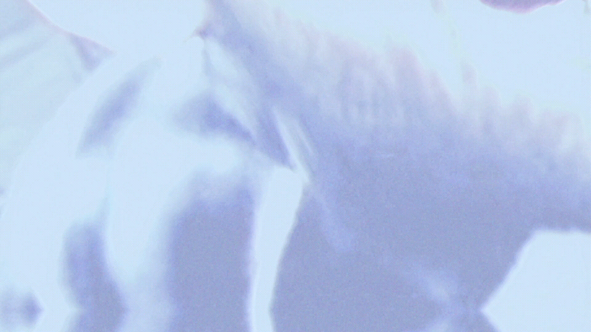 VNUS - Stupid Dream